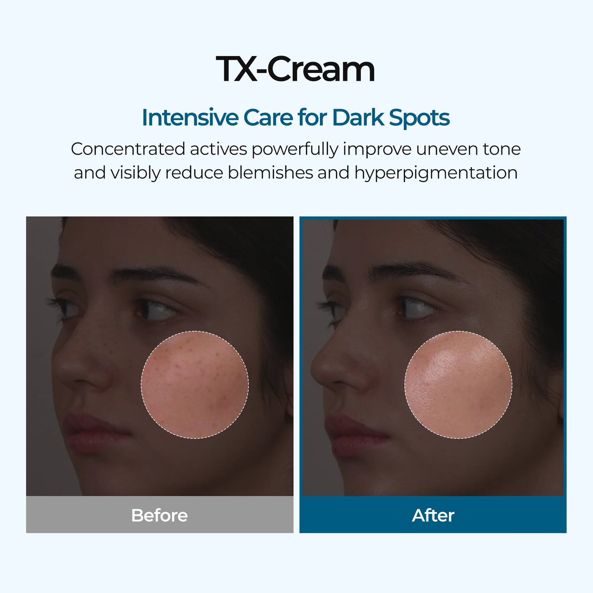 Dr.Melaxin, TX CREAM, 50ml