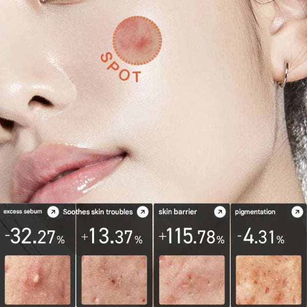 Anua CENTELLA RED SPOT CREAM 30g