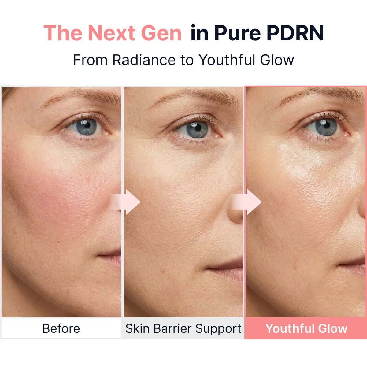 Sungboon Editor PDRN Pink Vitamin Glow Boosting Ampoule,40 ml