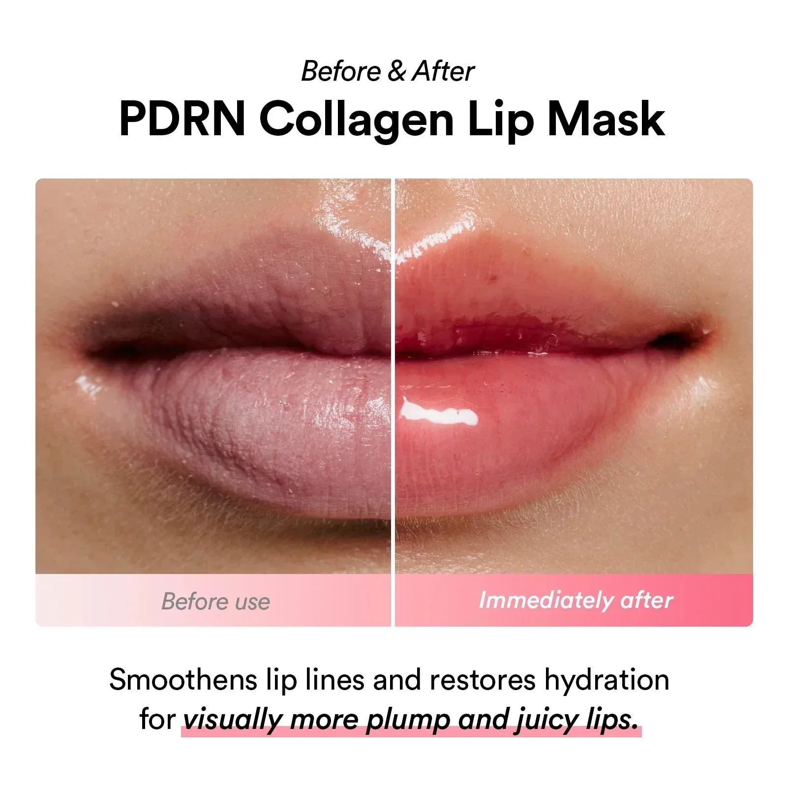 Abib PDRN Eyes and Lips Bundle Set - Seoulma-skincare