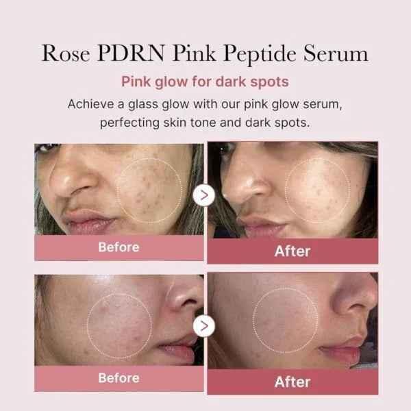 Medicube - PDRN Pink Peptide Serum 30 ml - Seoulma-skincare