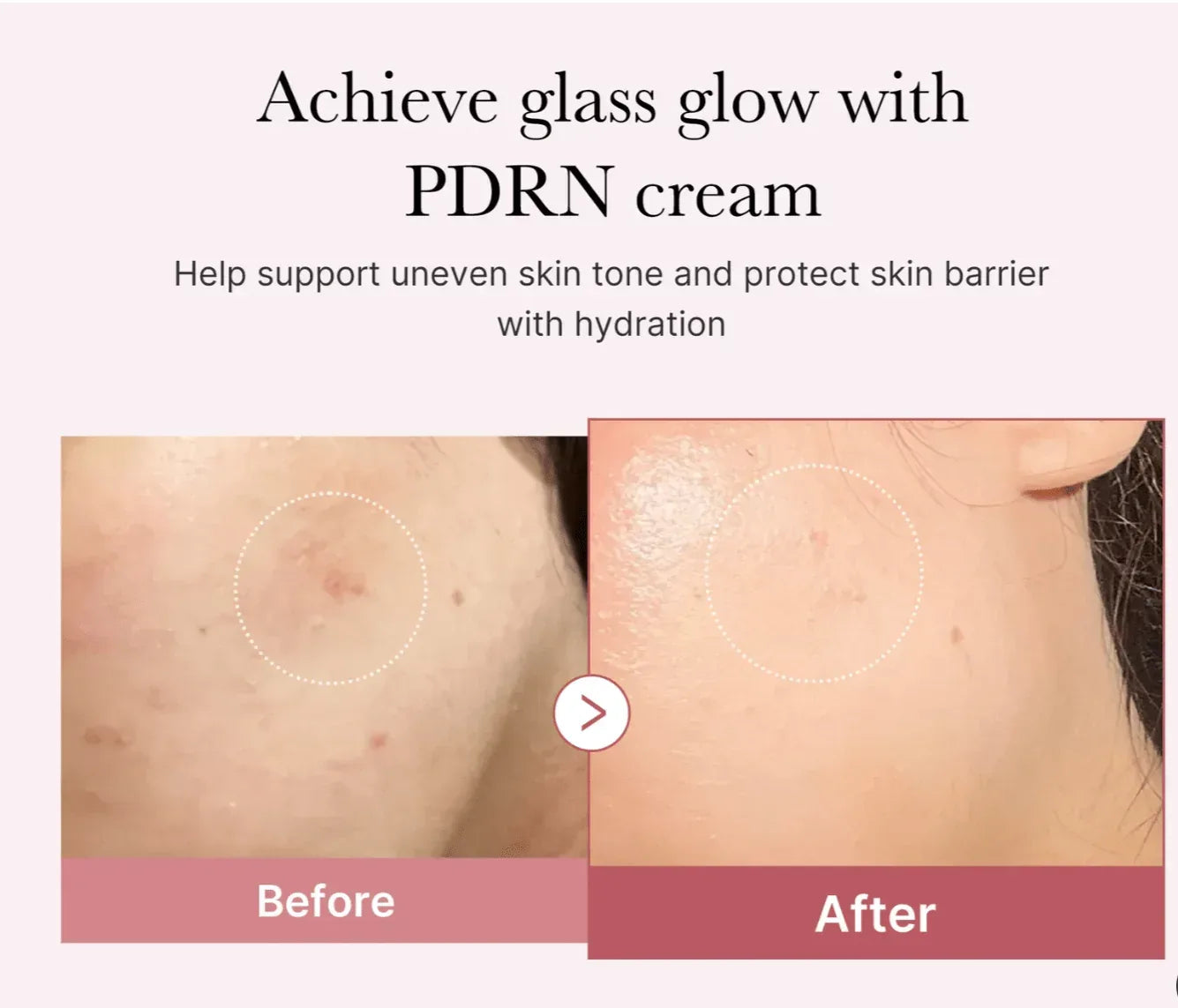 Medicube Salmon DNA PDRN Pink Hyaluronic Cream, 50ml - Seoulma-skincare