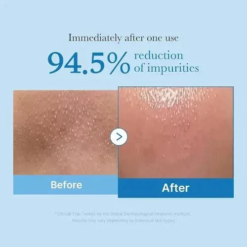 Medicube Zero Pore Blackhead Deep Cleansing Oil 205ml - Seoulma-skincare