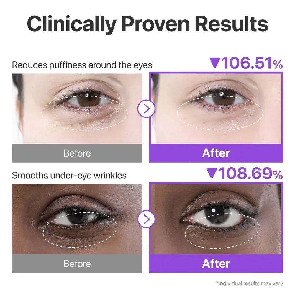Numbuzin – No.9 NAD+ Eye Patches, 5 pairs | Seoulma-skincare - Seoulma-skincare